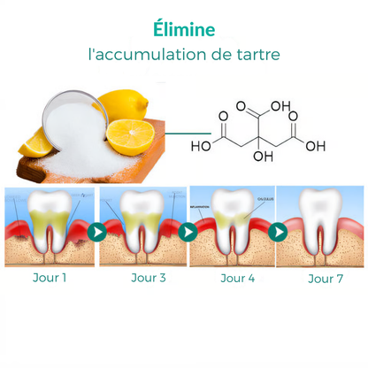 GEL RÉPARATEUR PET® | SOINS BUCAUX-DENTAIRE | ÉLIMINE LE TARTRE ET LES ODEURS